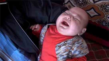 Epilepsi Bebek Belirtileri ve Tedavisi