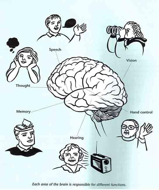 Parsiyel Epilepsi